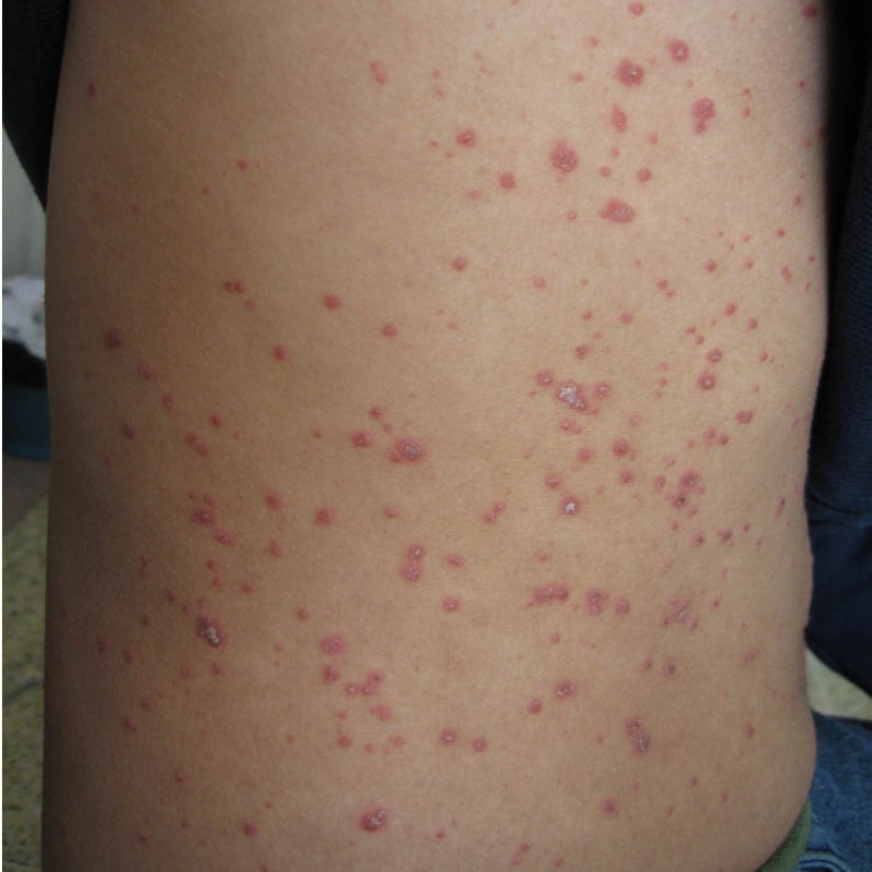 長春膚康皮膚醫院