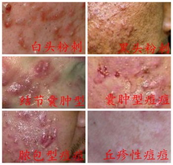 長(zhǎng)春膚康醫(yī)院