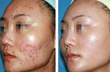 長(zhǎng)春膚康醫(yī)院