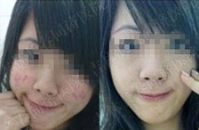 長(zhǎng)春膚康醫(yī)院