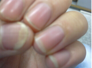 上海皮膚病醫院