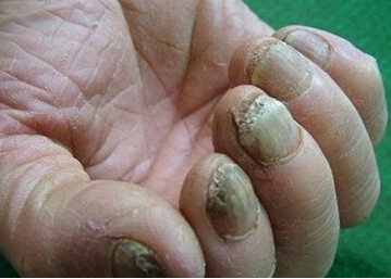 長(zhǎng)春皮膚病醫(yī)院