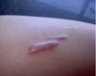 長春皮膚病醫(yī)院