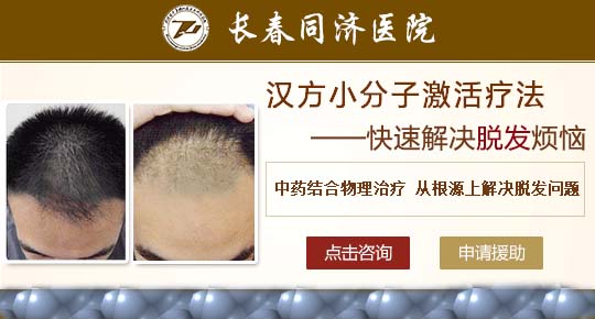 治療脫發選擇長春膚康醫院
