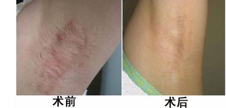 長春皮膚病醫院