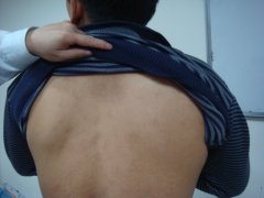 長春膚康醫院 白癜風