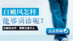 長春治療白癜風