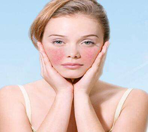 白癜風(fēng)早期發(fā)病的癥狀