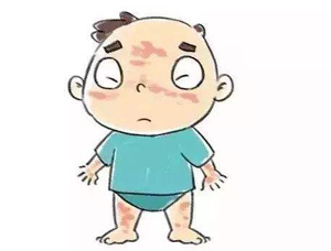 怎樣區分終究是不是白癜風?