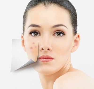 不安全祛除雀斑的方法有哪些?