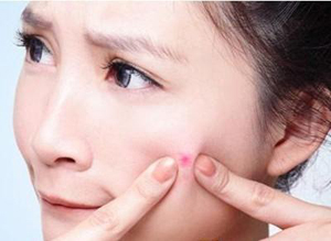 臉上出現(xiàn)水泡類似的痘痘要如何進(jìn)行護(hù)理