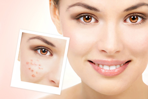 雀斑和雀斑樣痣有何不同