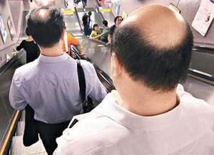 傳統(tǒng)脫發(fā)治療方法