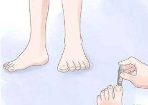 夏季到了有腳氣怎么辦