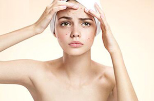 哪些方法可以祛除痘痘