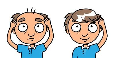 電腦族如何應對脫發