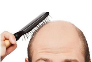 女性脫發(fā)比男性脫發(fā)更嚴(yán)重