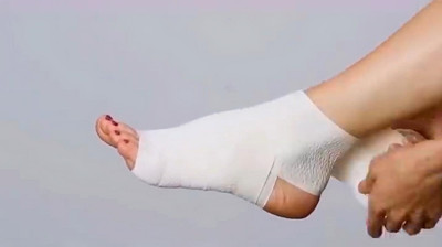 疤痕修復過程中常見的9個問題