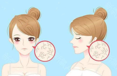 什么是肌膚“假性”過敏?