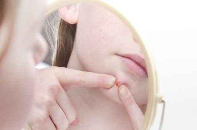 為什么不能用手擠青春痘