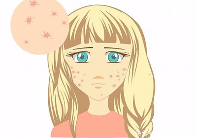 長春治療扁平疣需要多少錢