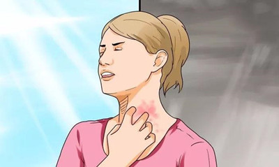 過敏容易誘發哪些皮膚疾病