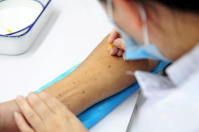 治療蕁麻疹一定要查過敏源嗎