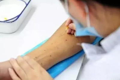 皮膚科醫生是如何檢查病情的