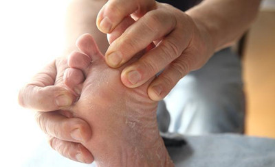 秋季治療手足癬的優勢