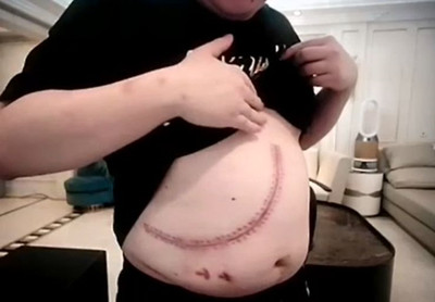 術后瘢痕修復掛號哪科