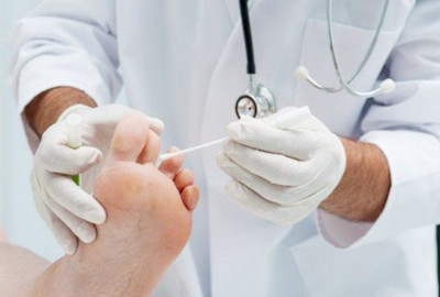 皮膚真菌感染是怎么引起的