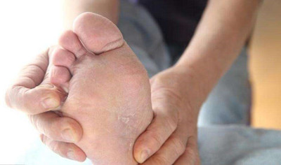 為什么到冬季手腳就容易干裂?