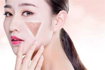 一年之“肌”在于春,抓住春天祛斑黃金期!