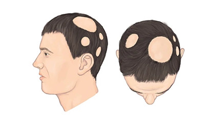 L(zhng)wƤwt(y)Ժʲô(hu)ͻȻ߶dԓôk