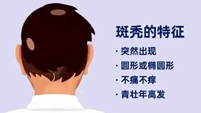 為什么會突然斑禿,該怎么辦?