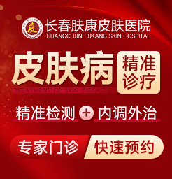 長(zhǎng)春皮膚醫(yī)院,蕁麻疹是否有傳染性