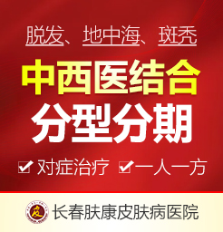 長春皮膚科醫院免費問診脂溢性脫發如何治療