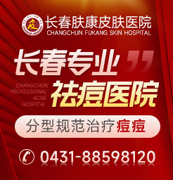 長春下巴老是長痘看什么科